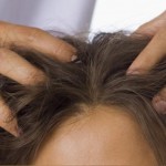 dry scalp hair loss